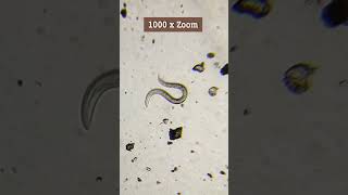 LOOK what I found in Soil🤯CloseUp of Nematodes under the Microscope shorts nematode microbiology [upl. by Nosde540]