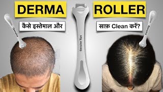 How to Use and Clean Derma Roller to Stop Hair Fall  When to Use  Which Needle  For Men and Women [upl. by Arielle]