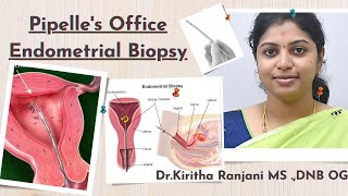 Pipelles Endometrial Office Endometrial BiopsyEndometrial SamplingNO ANAESTHESIAOP PROCEDURE [upl. by Oigufer]