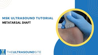 Musculoskeletal ultrasound evaluation of the metatarsal shaft [upl. by Ytsur]