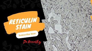 Reticulin stain [upl. by Alliw]