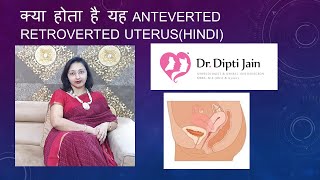 क्या होता है यह Anteverted Retroverted UTERUSHINDI [upl. by Katheryn626]