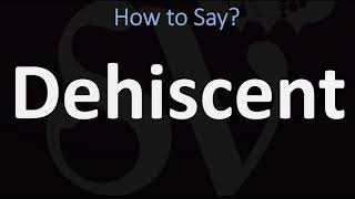 Superior Semicircular Canal Dehiscence  Rachels Story [upl. by Nyllij]