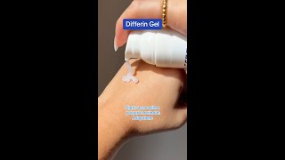 Why We Love Differin Gel for Treating and Preventing Acne [upl. by Nhguavoj]