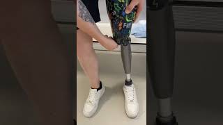 prosthetic leg physiotherapyclinic foot physiotherapyservices kneeexercises painfreelife [upl. by Nichol]