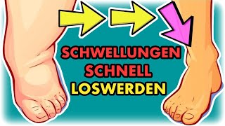 Schwellungen sofort reduzieren Effektive LymphÜbungen für zu Hause [upl. by Lindgren528]