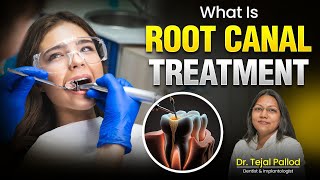 Root Canal Treatment  Is Root Canal Painful Procedure Symptoms and Costs by Dr Tejal Pallod [upl. by Ahseym945]