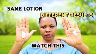 This is why Your body Lotion is Causing you Skin reactionsgreen veinsstretch marks amp white patches [upl. by Wittie]