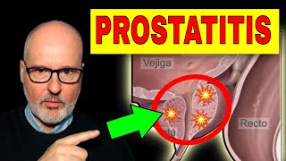 PROSTATITIS AGUDA y CRÓNICA Síntomas Causas y Tratamiento [upl. by Cyprio53]