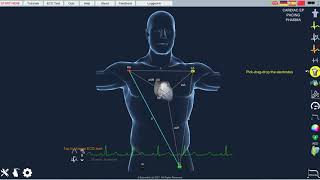 Epicardio Simulation Brief Introduction [upl. by Psyche]