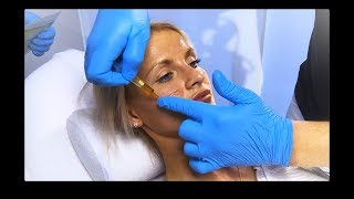 viliv Maske  skinmed  Plastische und Ästhetische Chirurgie und Dermatologie [upl. by Shifrah]