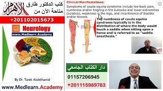 Cauda Equina Syndrome neurology usmle internalmedicine cme ecg  محاضراتباطنة [upl. by Call]