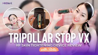 Tripollar STOP Vx RF Skin Tightening Device Review  Stellar [upl. by Brandon]