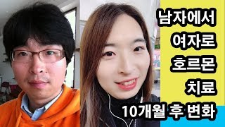 남자에서 여자로 호르몬 치료 10개월 후 변화 MTF HRT after 10 Months  Transgender 트랜스젠더 [upl. by Haelat]