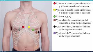 ¿CÓMO Y DÓNDE COLOCAR LOS ELECTRODOS PRECORDIALES [upl. by Atiras]