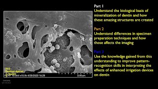 SEM Imaging Biomineralization Part 1 [upl. by Atrahc]