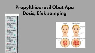 Propylthiouracil Obat Apa  Dosis efek samping propylthiouracil [upl. by Kloman]