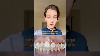 LA VERITÉ SUR LES TACHES APRÈS LES BAGUES DENTAIRES  🦷 dentiste orthodontie appareildentaire [upl. by Vevay]