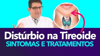 Distúrbios da tireoide sintomas e tratamentos  Dr Juliano Teles [upl. by Barden]