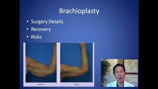 How to Get Rid of Loose Skin of the Arms  Brachioplasty Consultation  Dr Anthony Youn [upl. by Kris521]