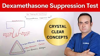 Dexamethasone Suppression Test  Dr Sadiq Ali [upl. by Mettah]