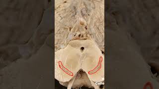 Substantia nigra pars compactaneuroanatomy brainstembasalganglia dopaminehumanbrainbrain [upl. by Mlehliw415]