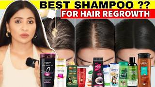 I used this👆🏼trick to treat hair thinning Got Full Hair Growth in 1 MonthThick Dense Hair Shampoo [upl. by Gabey428]