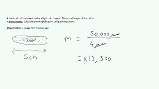 Microscopes amp Magnification  Exam Question AQA GCSE Biology [upl. by Lekim67]