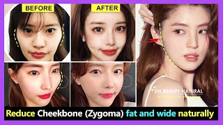 How to reduce Cheekbone fat and wide Zygomatic bone reduction without surgery  Exercise amp Massage [upl. by Marguerie]