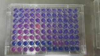 Resazirun Test for Metabolic Activity of Bacteria [upl. by Egedan]