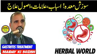 Gastritis Treatment  Maiday Ki Sozish Ka Ilaj  Herbal world [upl. by Calista501]