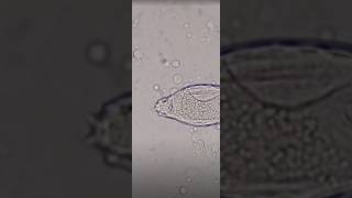 schistosoma haematobium in urine slide test viral shorts [upl. by Yenatirb]