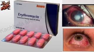 Antibiotic tablet ।। Erythromycin ।। Eye infection ।। Optometry Solution [upl. by Huntington]