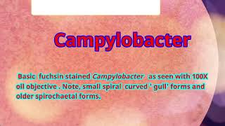 Basic fuchsin stained Campylobacter under microscope Curved bacteria [upl. by Oina]