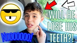 WILL HE LOSE HIS TEETH🙀 79 VLOG [upl. by Anidem]