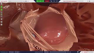 HeartWorks Cardiac Anatomy Module [upl. by O'Gowan]