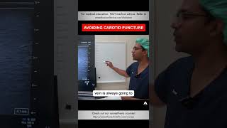 Avoiding Carotid Puncture  shorts cvc anesthesiology nurse [upl. by Yks]