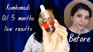 Kumkumadi oil skin benefits amp how to use correctly  Kumkumadi oil after 5 months for oily skin [upl. by Yug35]