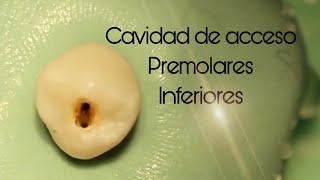 Cavidad de acceso premolares inferiores  Access cavity lower premolars [upl. by Pernick145]