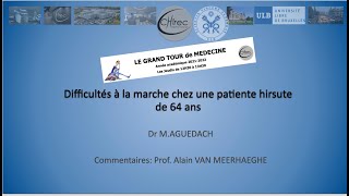 Troubles de la marche et hirsutisme chez une patiente de 64 ans Cyprotérone et méningiome [upl. by Ailima]