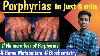 Porphyrias  Heme metabolism Biochemistry  Vidushi Medatwal  Ashish ampTeam [upl. by Llennoj]