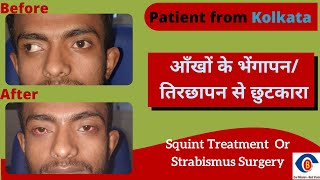 Best Squint Surgery in India  Strabismus Treatment  भेंगेपन का इलाज  Patient From Kolkata [upl. by Kleiman]