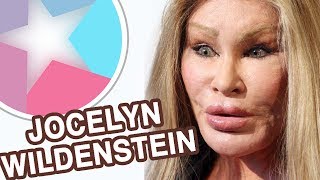 Jocelyn Wildenstein Before And After  Then And Now  Changing Face [upl. by Airotcivairam800]