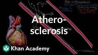 Atherosclerosis  Circulatory System and Disease  NCLEXRN  Khan Academy [upl. by Gonta650]