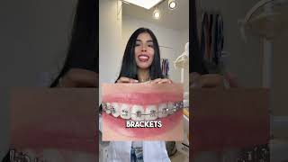 COLORES DE GOMITAS DE BRACKETS PARA DIENTES BLANCOS✨ shorts [upl. by Wehttam595]