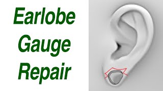 Earlobe Gauge Repair Both Small and Large Sizes [upl. by Obla449]