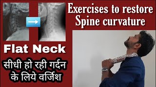 How to restore cervical curve  Exercises for straightening of cervical spineLoss of Lordosis [upl. by Curt]