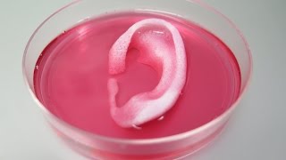 3D Printed Human Tissue Created For Transplant [upl. by Euqenimod]