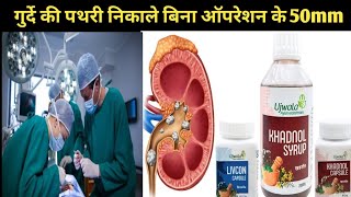 पथरी निकाले बिना ऑपरेशन के  livcon capsule khadnol syurp  khadnol livcon capsule khadnol syrup [upl. by Chanda]