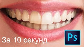 Белые зубы в фотошопе за 10 секунд [upl. by Redmond]